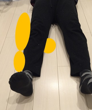 大腿骨頚部 転子部骨折の合併症とは 予防のための簡単リハビリ方法をご紹介 かずぼーのリハビリ大全