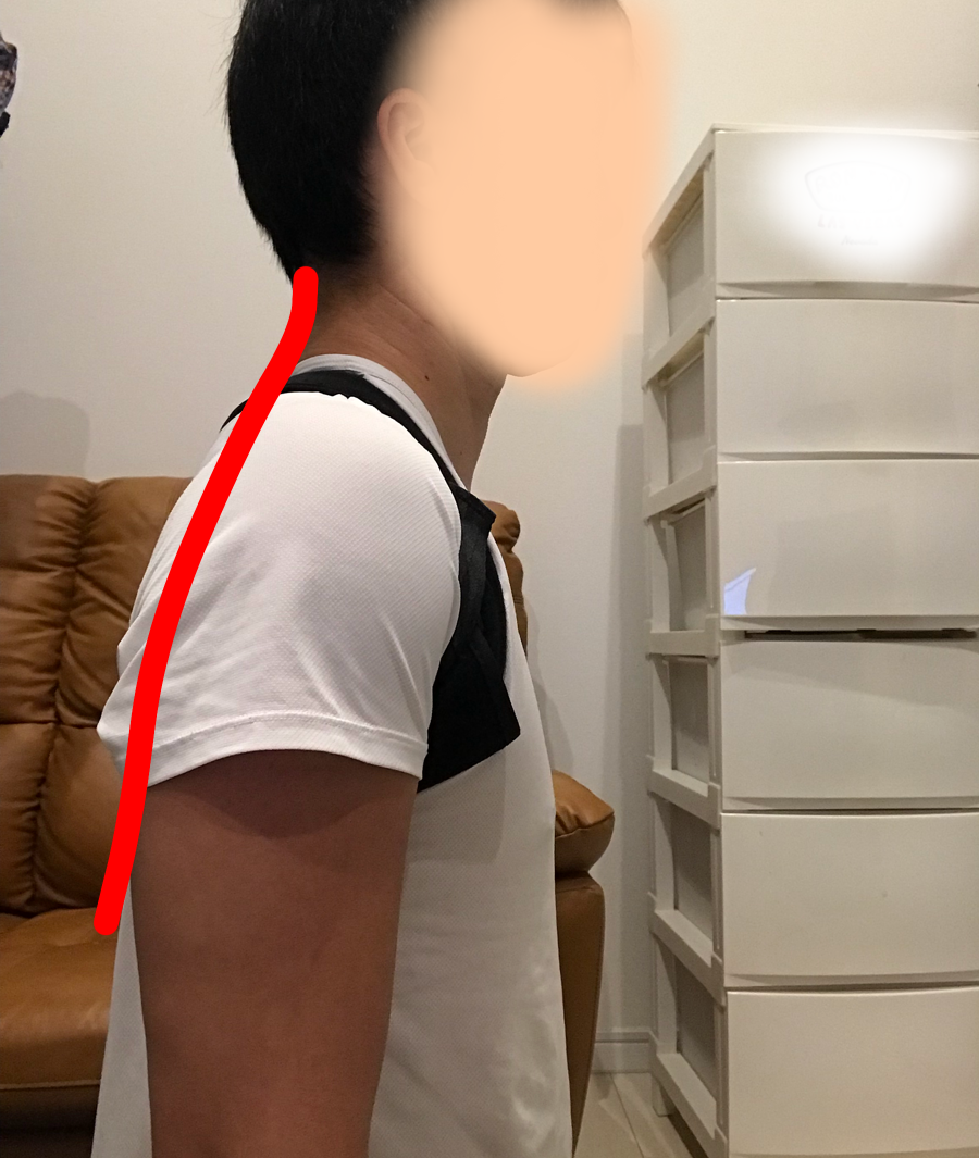 首・肩に痛みがある人におすすめ！理学療法士が"背筋矯正サポーター（猫背矯正ベルト）"を使ってみた結果